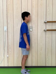 小学生の猫背姿勢（改善前）｜頭が前に出る姿勢の例