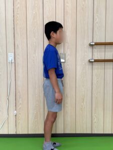 小学生の姿勢改善（改善後）｜肩と頭の位置が整った状態